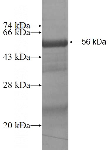 Recombinant Human ARD1B SDS-PAGE