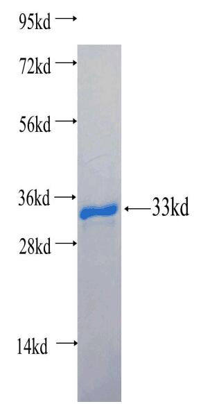 Recombinant human MT3 SDS-PAGE