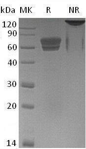 Mouse Edar/Dl (Fc tag) recombinant protein