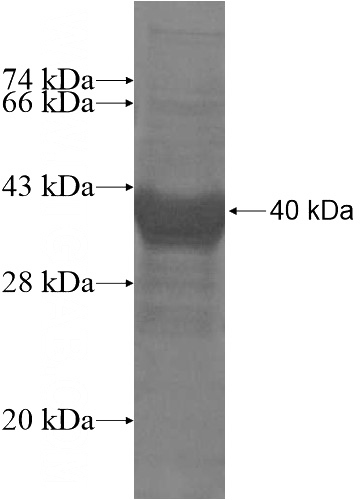 Recombinant Human ZNF839 SDS-PAGE