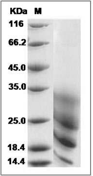 Rat CD63 / Tspan-30 / Tetraspanin-30 Protein (His Tag) SDS-PAGE