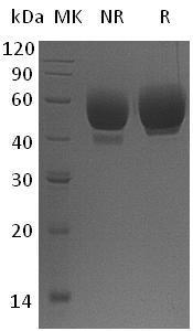 Human VSIG4/CRIg/Z39IG/UNQ317/PRO362 (His tag) recombinant protein
