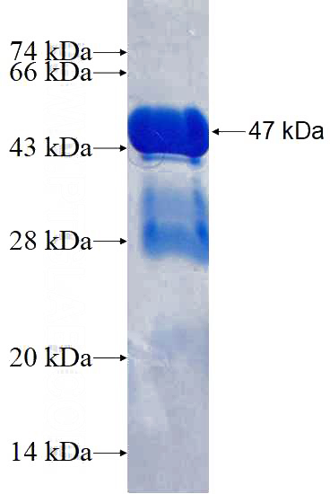 Recombinant Human RGS10 SDS-PAGE