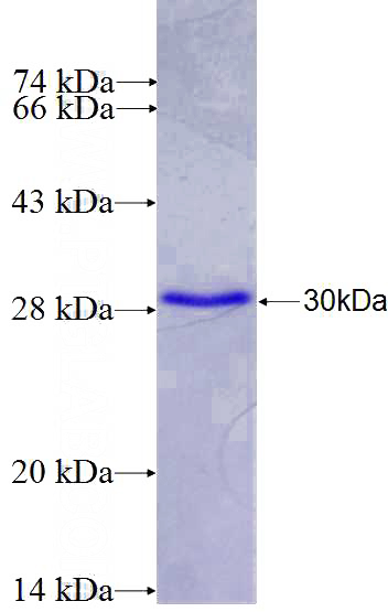 Recombinant Human HSPBAP1 SDS-PAGE