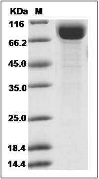 Cynomolgus IL18R1 Protein (Fc Tag) SDS-PAGE