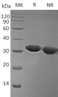 Human ESD (His tag) recombinant protein