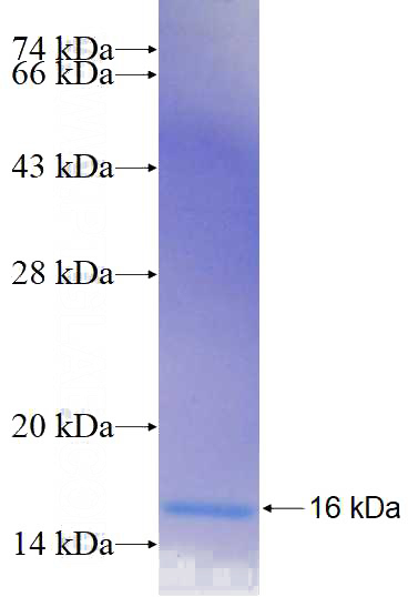 Recombinant Human ACOT6 SDS-PAGE