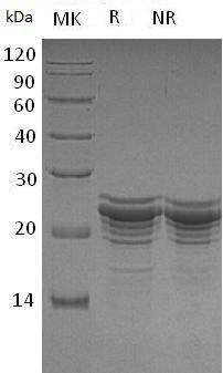 Human FGF21/UNQ3115/PRO10196 (His tag) recombinant protein