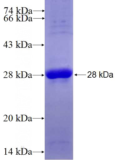 Recombinant Human NDUFS4 SDS-PAGE