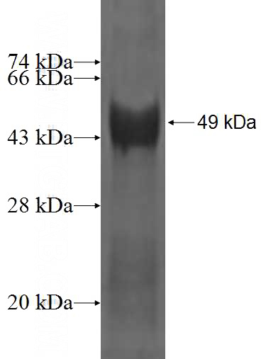 Recombinant Human LIN28 SDS-PAGE