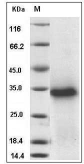 Mouse TWSG1 Protein (His Tag) SDS-PAGE
