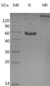 Mouse Fzd2/Fzd10 (Fc tag) recombinant protein