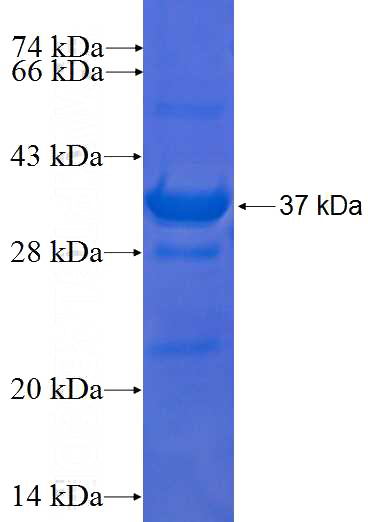 Recombinant Human VANGL1 SDS-PAGE