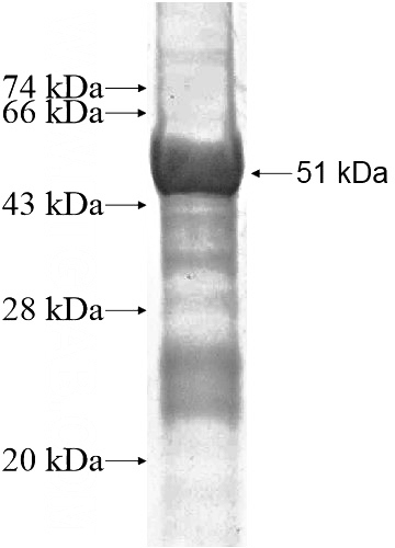Recombinant Human ZNF511 SDS-PAGE