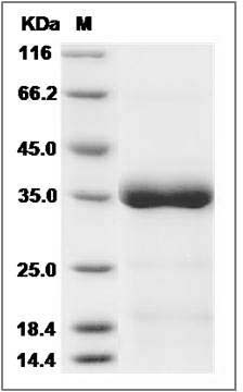 Human ANGPTL4 Protein (His Tag) SDS-PAGE