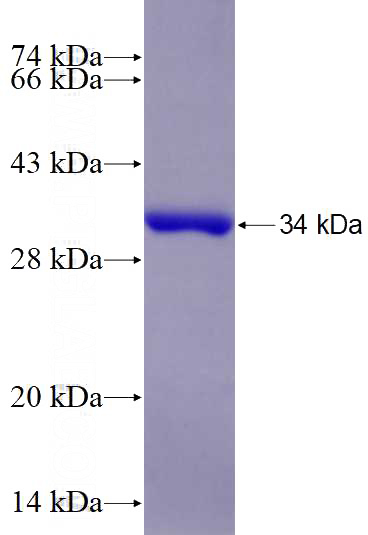 Recombinant Human RGS22 SDS-PAGE