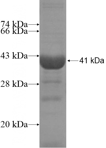 Recombinant Human PDZD7 SDS-PAGE