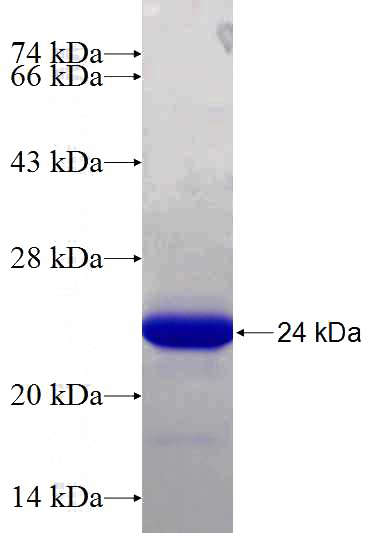Recombinant Human PHF20L1 SDS-PAGE