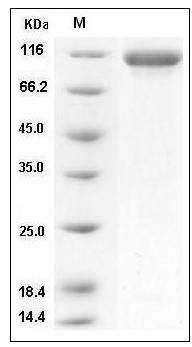 Mouse IL6ST / gp130 / CD130 Protein (His & Fc Tag) SDS-PAGE
