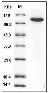 Human TGM2 / Transglutaminase 2 Protein (His Tag) SDS-PAGE