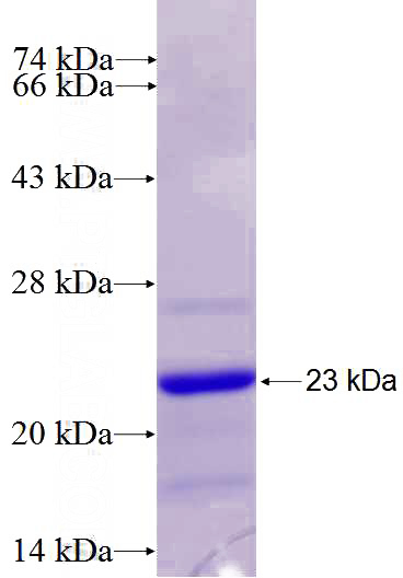 Recombinant Human CD37 SDS-PAGE