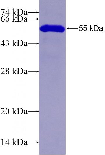 Recombinant Human CDC2L1 SDS-PAGE