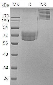Human HAVCR2/TIM3/TIMD3 (Fc & Avi tag) recombinant protein