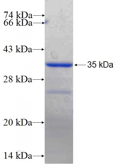 Recombinant Human MCF2L SDS-PAGE