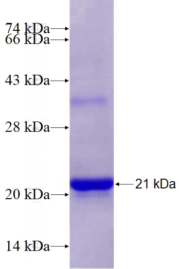 Recombinant Human CCNG2 SDS-PAGE