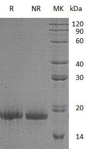Human TAC1/NKA/NKNA/TAC2 (His tag) recombinant protein