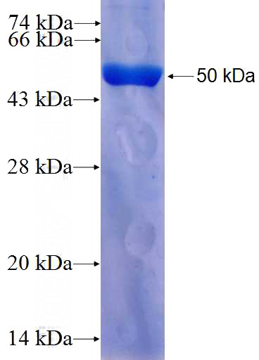 Recombinant Human IFT74 SDS-PAGE