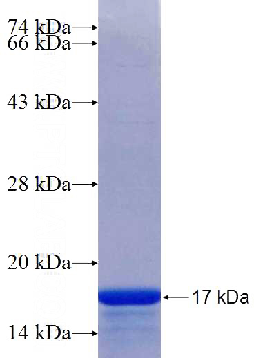 Recombinant Human TTYH1 SDS-PAGE