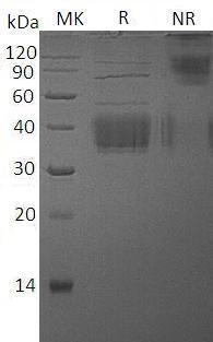 Mouse Tnfsf9/Cd137l/Cd157l/Ly63l (His tag) recombinant protein