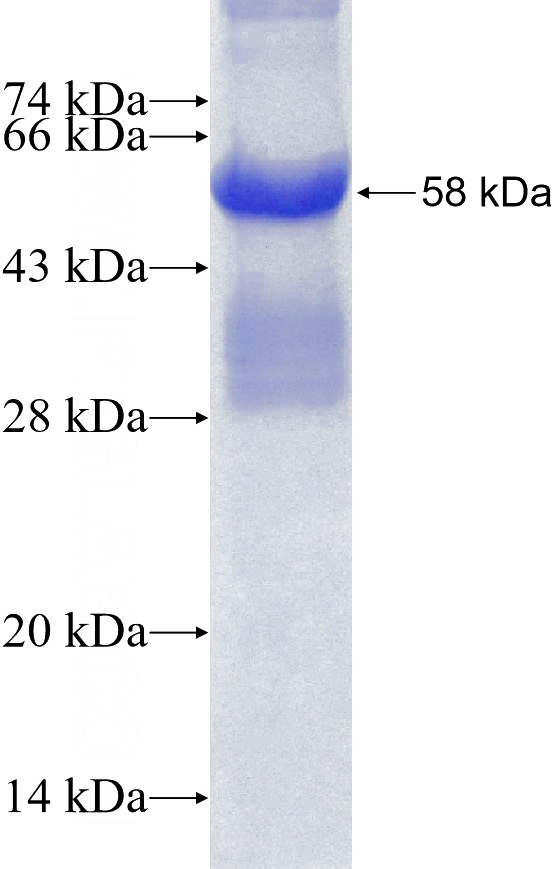 Recombinant Human PLXNB2 SDS-PAGE