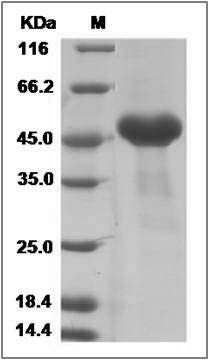 Mouse CRELD1 Protein (His Tag) SDS-PAGE