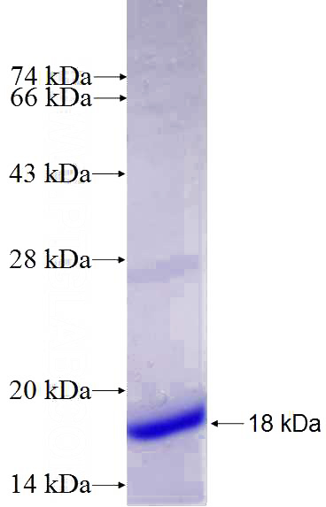 Recombinant Human CD151 SDS-PAGE