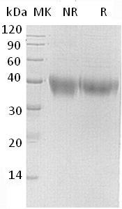 Human TNFRSF1B/TNFBR/TNFR2 (His tag) recombinant protein