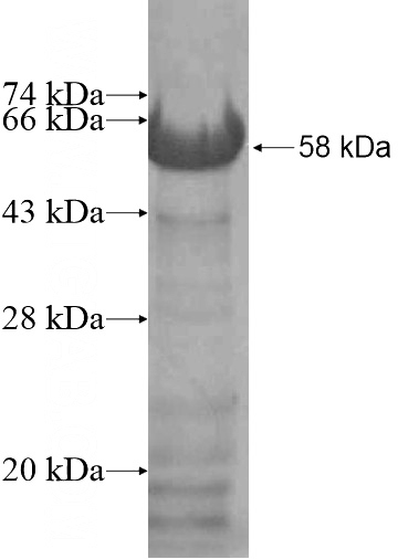 Recombinant Human CARD6 SDS-PAGE