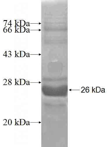 Recombinant Human NIPBL SDS-PAGE