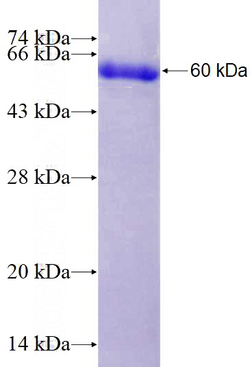 Recombinant Human CRYM SDS-PAGE