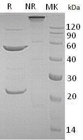 Human DKK2/UNQ682/PRO1316 (Fc & His tag) recombinant protein