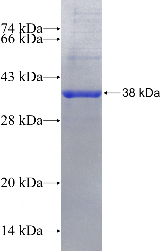 Recombinant Human KLHL25 SDS-PAGE