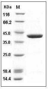 Human GFPT1 / GFAT Protein SDS-PAGE
