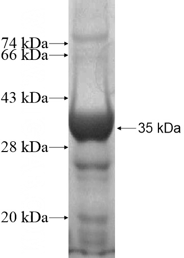 Recombinant Human RNF6 SDS-PAGE
