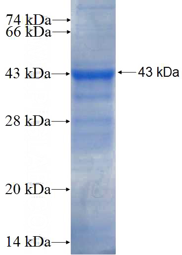 Recombinant Human EDN3 SDS-PAGE