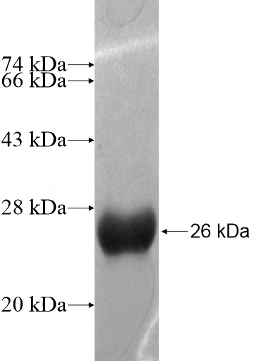 Recombinant Human LARP2 SDS-PAGE