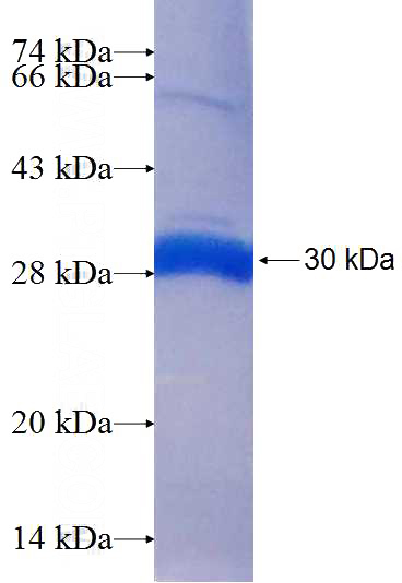 Recombinant Human DCUN1D5 SDS-PAGE