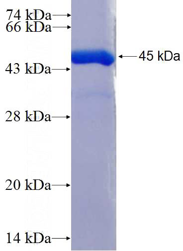 Recombinant Human BRAP SDS-PAGE
