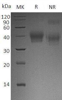 Human BTN2A1/BT2.1/BTF1 (His tag) recombinant protein