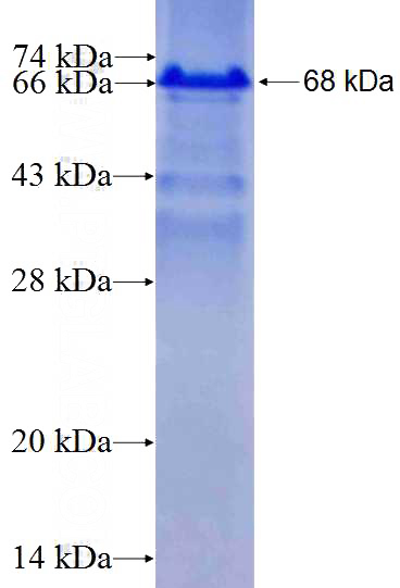 Recombinant Human RREB1 SDS-PAGE